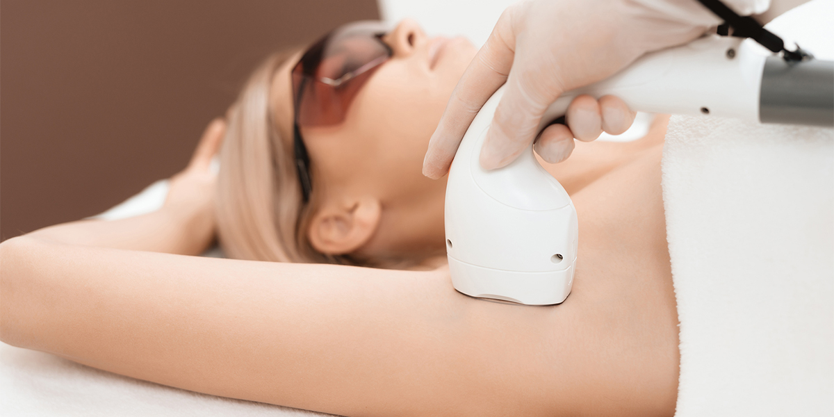 Epilation définitive : choisir entre laser ou lumière pulsée (IPL