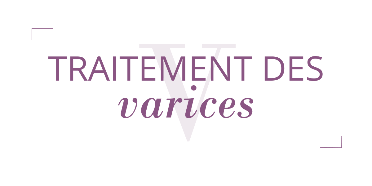 Varices