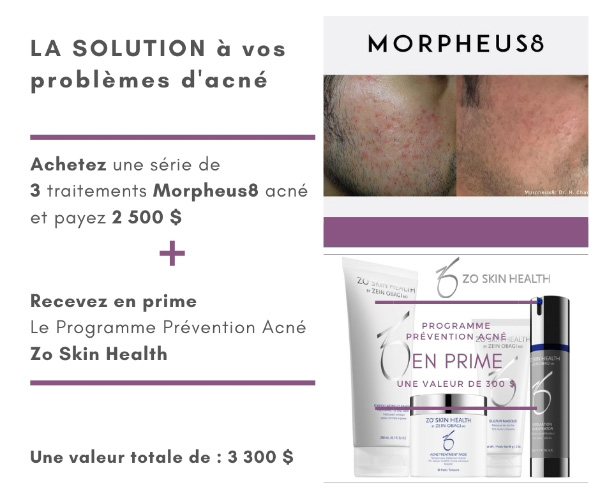 promo septembre acne-600×503