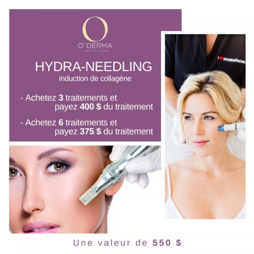hydra needling