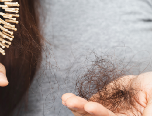 Vous êtes touché par la perte de cheveux? Voici des solutions!