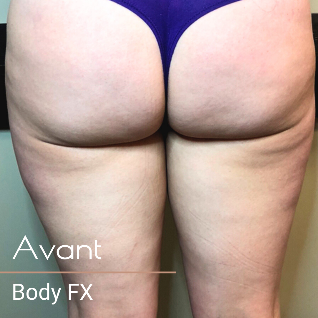 Body FX avant